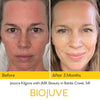 BIOJUVE Living Biome Essentials Duo BIOJUVE Living Biome Essentials Duo