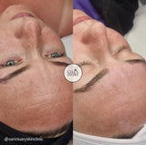 Cellstory Facial