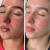 Cellstory Facial