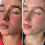Cellstory Facial