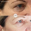 Cellstory Facial