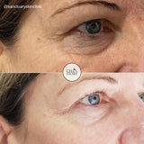 Cellstory Facial