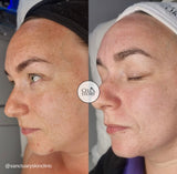 Cellstory Facial