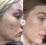 Cellstory Facial