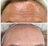 Cellstory Facial