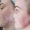 Cellstory Facial